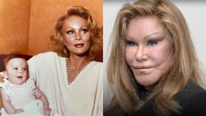 Diane Wildenstein: Before & After "Catwoman" - Inside Her Life