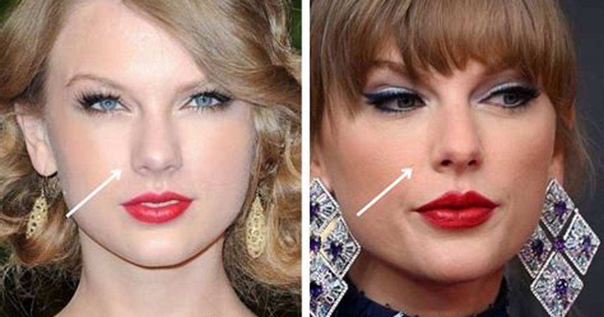 Did She Get Nose Job?