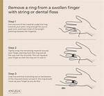 Effective Techniques for Removing a Ring with Floss