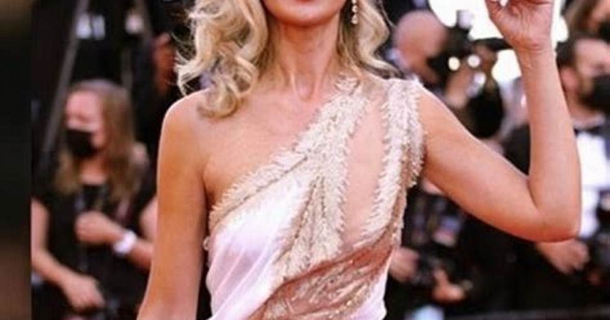 Has Lady Victoria Hervey Had a Stroke? Mouth and Face Drop Surgery Details