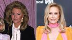 Has Rhobh Kathy Hilton Done Plastic Surgery? Fans Suspect Botox and Nose Job ·