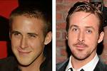 Has Ryan Gosling Received a Nose Job?