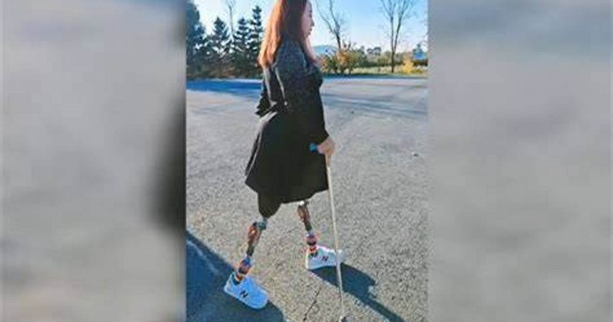 Inspiring Journeys: the Life of Amputee Dak