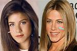 Jennifer Aniston's Nose Job and Plastic Surgery: Uncovering Hidden Truths