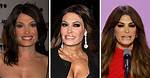Kimberly Guilfoyle's Transformative Weight Loss Journey: Surgery Success