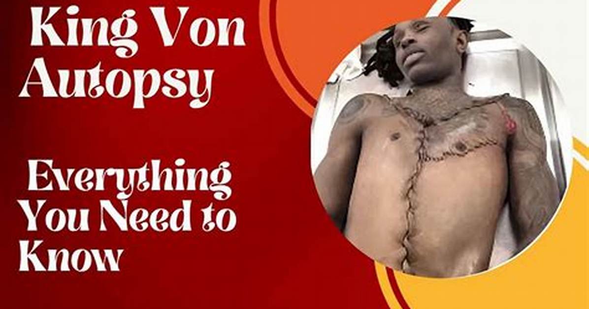 King Von's Autopsy: a Comprehensive Look into the Life and Death of a Rising Star