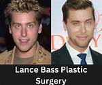 Lance Bass and His Journey Through Plastic Surgery