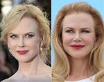 Nicole Kidman Breast Augmentation Truth Revealed