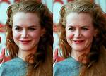 Nicole Kidman: the Ageless Beauty Without Surgery