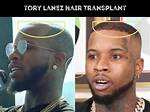 Tory Lanez's Bald Spot Provides Joey Fatts an Opportunity to Plug 'G Way 2' Album No Pun Intende