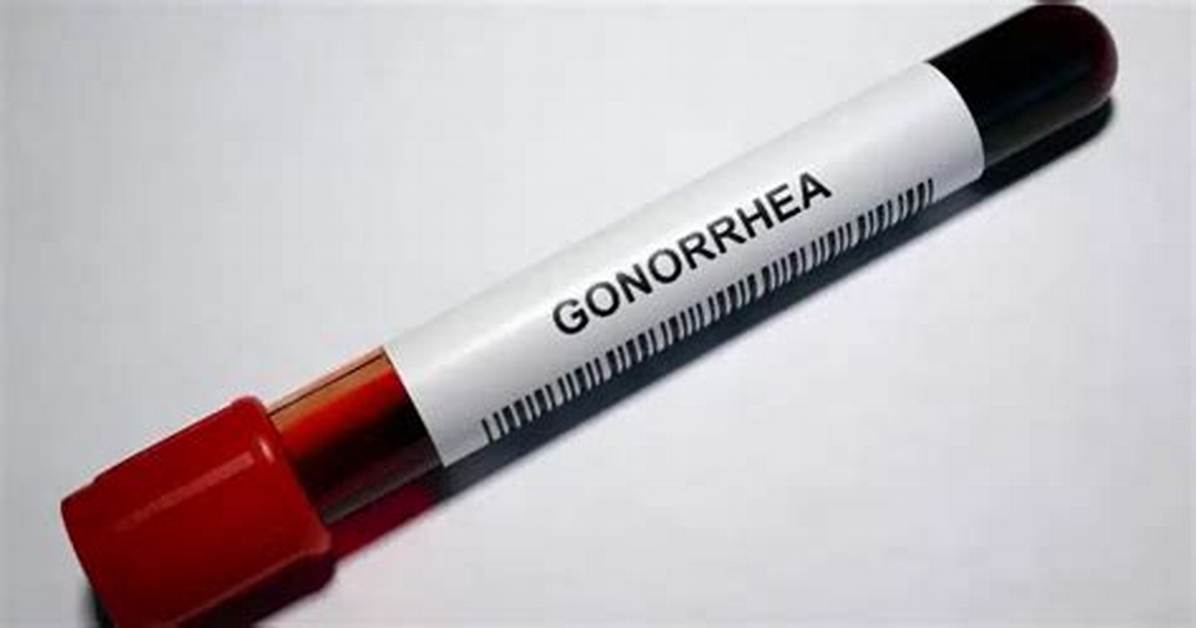 Understanding Usher Std: a Comprehensive Guide