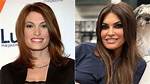 Unmasking the Transformation: What Has Kimberly Guilfoyle Done to Her Face?