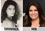 Unveiling the Transformation: Kimberly Guilfoyle Plastic Surgery Photos