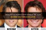 Unveiling the Truth Behind Tom Cruise's Bad Teeth