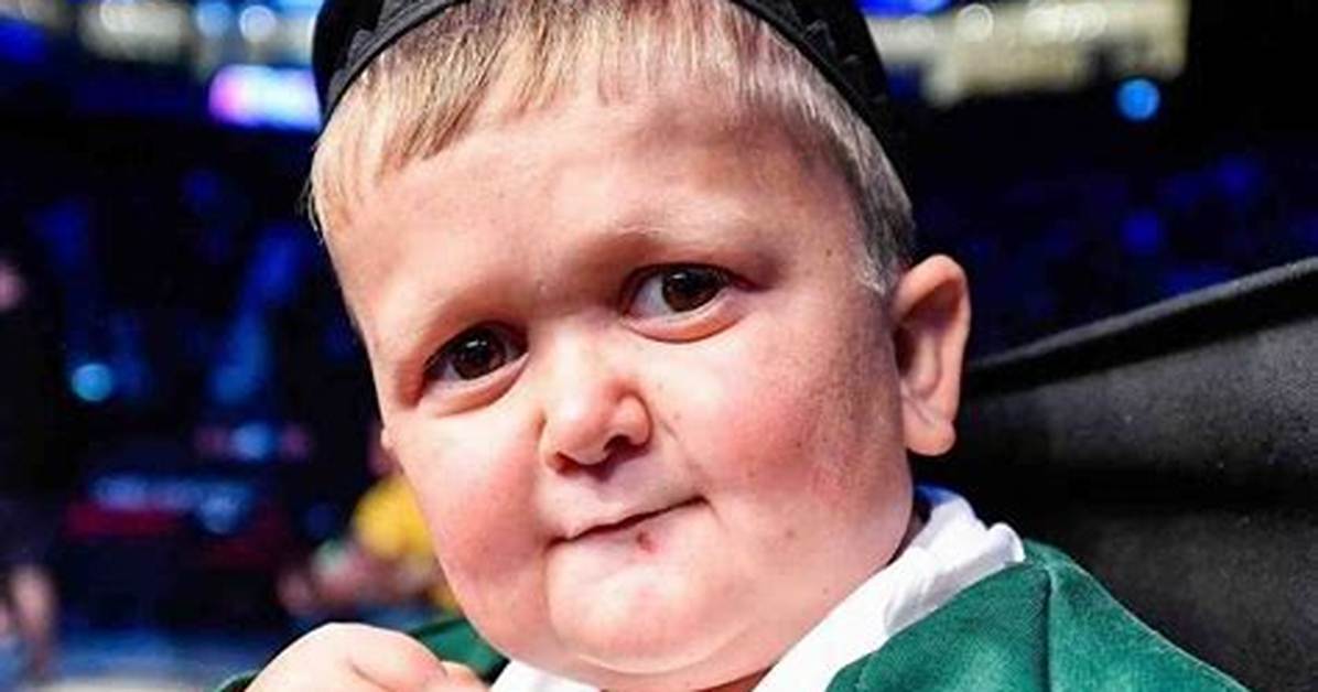 What Rare Medical Condition Does Hasbulla Have?